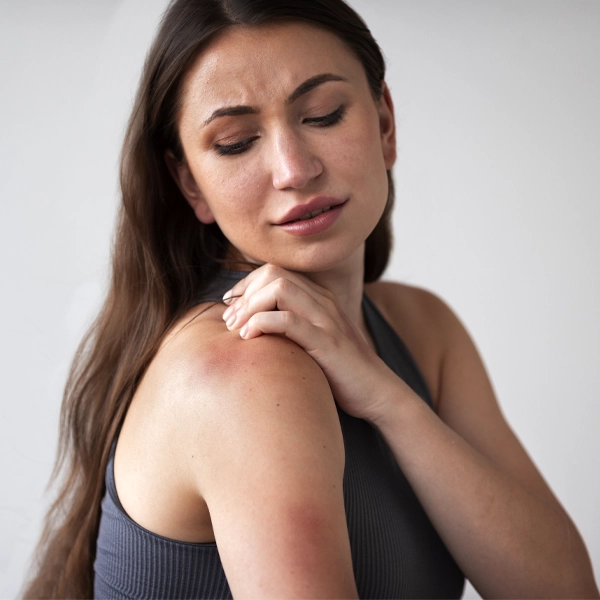 Sebodiane la soluzione per la Dermatite Seborroica ragazza con forte dermatite e prurito sulla spalla