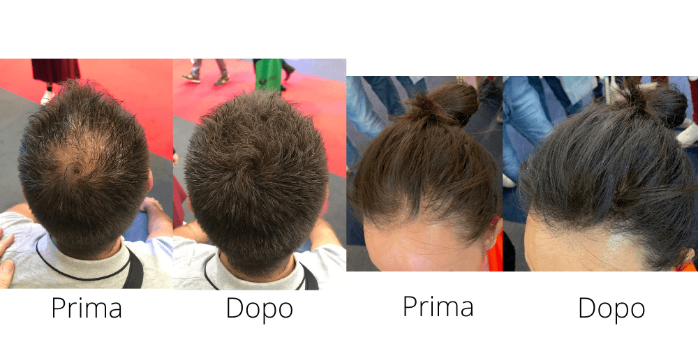 Toppik - prima e dopo fibre di cheratina