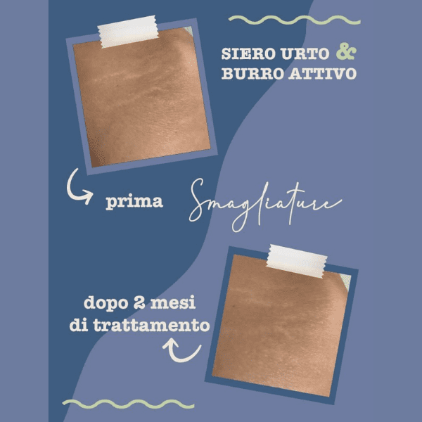 La Saponaria - Siero Urto Smagliature e Burro La Saponaria - Siero Urto Smagliature e Burro