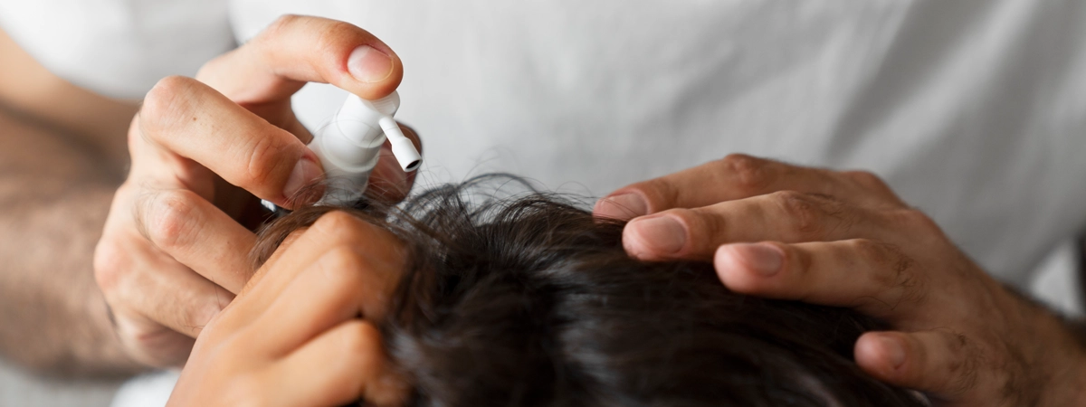 Come Scegliere lo Spray Anti Diradamento migliore parrucchiere che applica spray per coprire diradamento