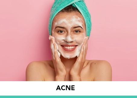 Acne-cell Acne desk
